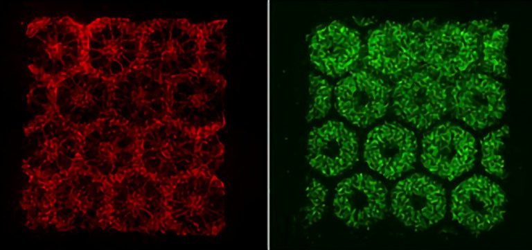 Schéma základného stavebného prvku pečene a mikroskopická fotografia pečeňového tkaniva, vytlačeného v biolaboratóriu univerzity v San Diegu