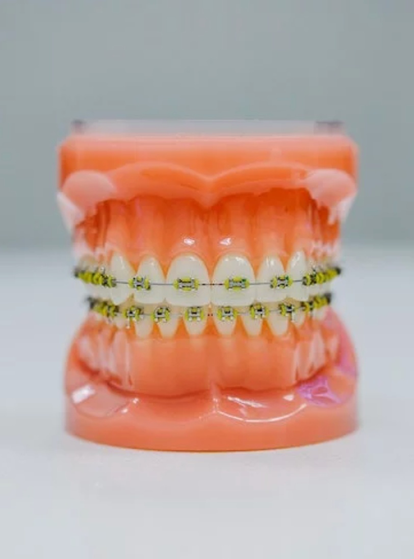Klasický strojček na zuby