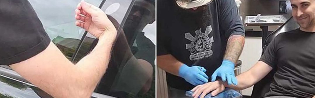 Majiteľ Tesly sa nechal začipovať, aby mohol rukou odomykať svoje auto