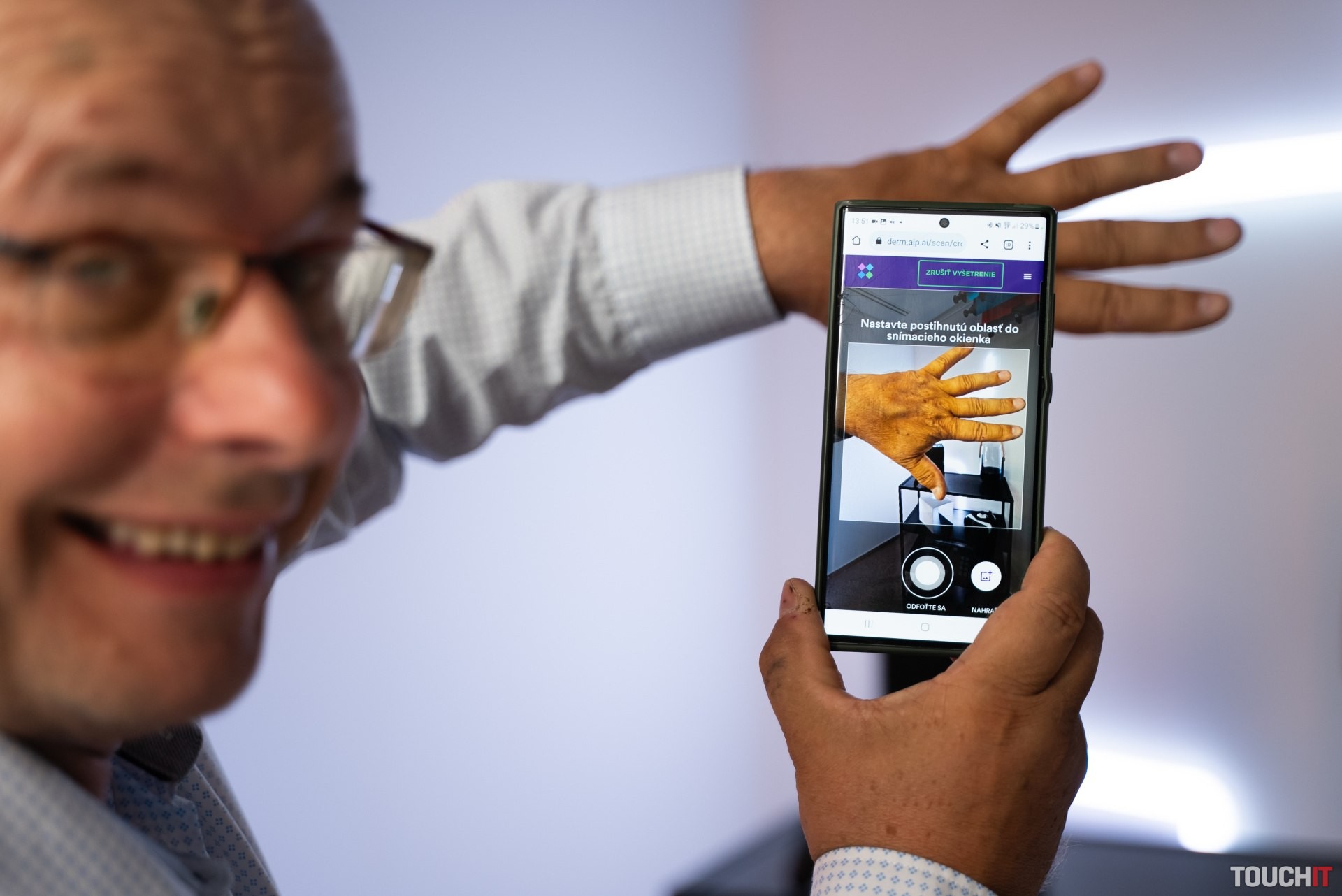 Kontrola pokožky lekárom cez mobilný telefón zadarmo. Toto sú podmienky