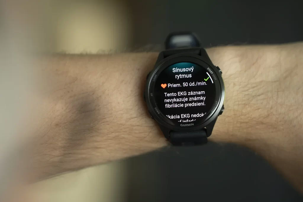 Garmin Forerunner 970