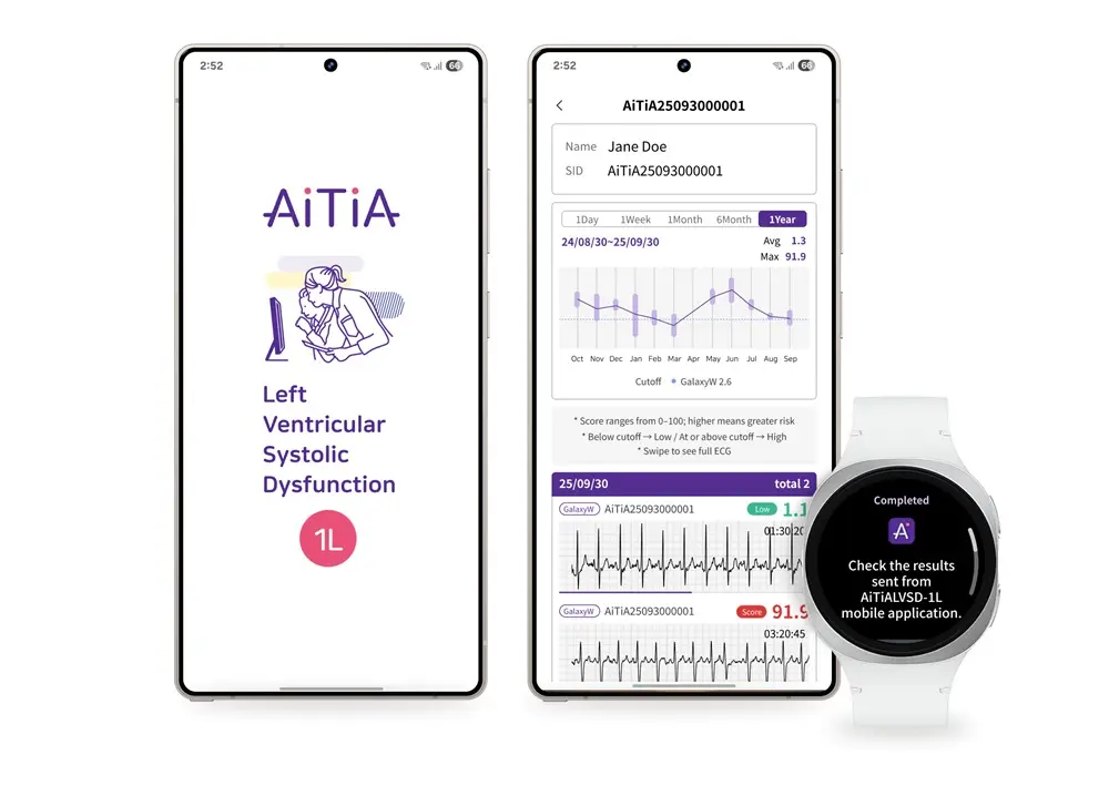Galaxy Watch dokážu detegovať a monitorovať systolickú dysfunkciu ľavej komory