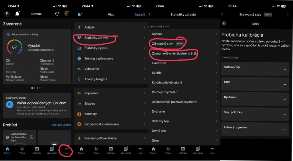 Garmin hodinky dostali novú funkciu Zdravotný stav