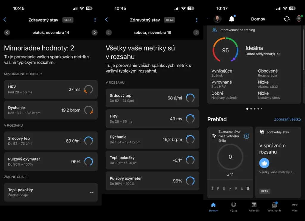 Garmin hodinky dostali novú funkciu Zdravotný stav