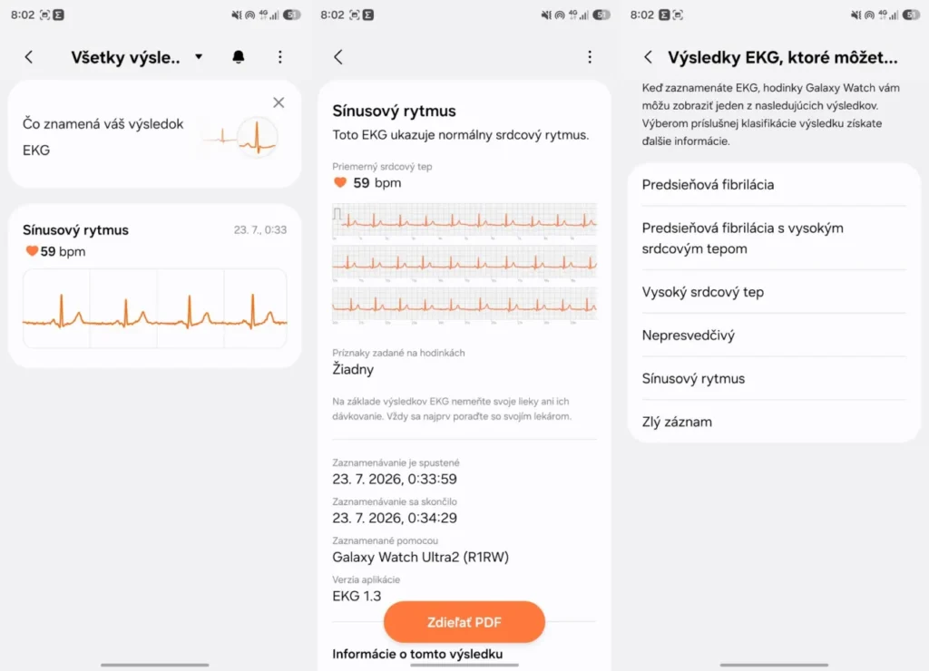 Meranie EKG pomocou hodiniek Samsung Galaxy Watch
