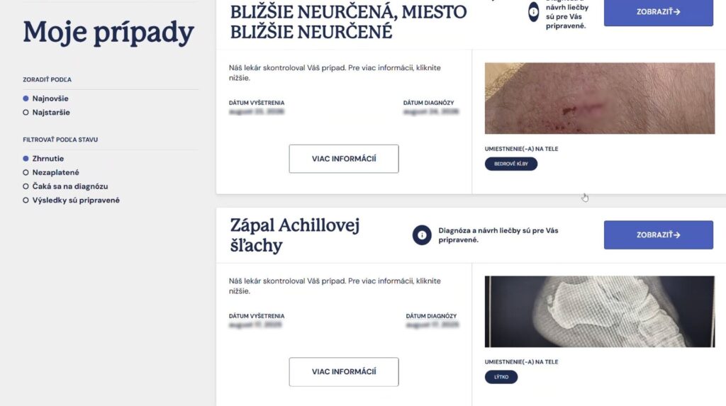 Výsledky z AI Fyzio