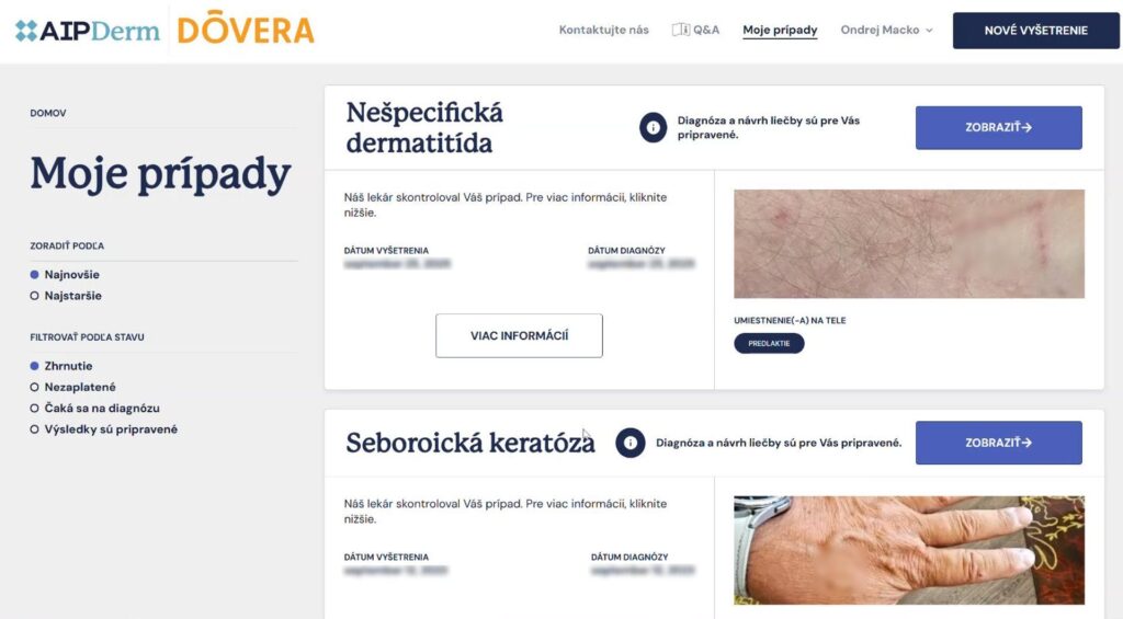 Výsledky vyšetrenia cez AI Derm